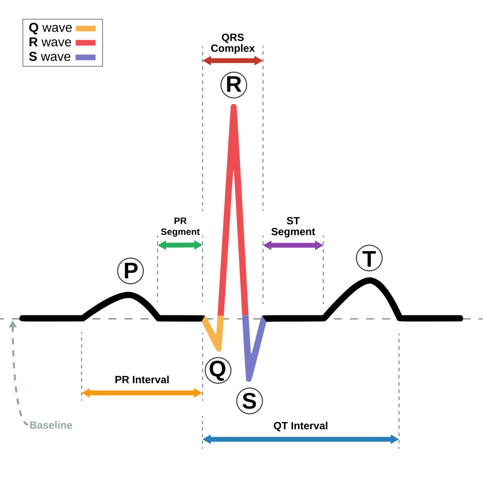 Labelled normal ECG waveform showing P wave, PR interval, QRS complex and QT interval